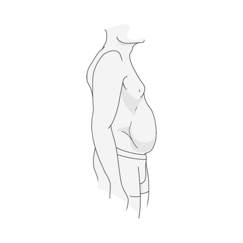 Stärkerer Bauch
